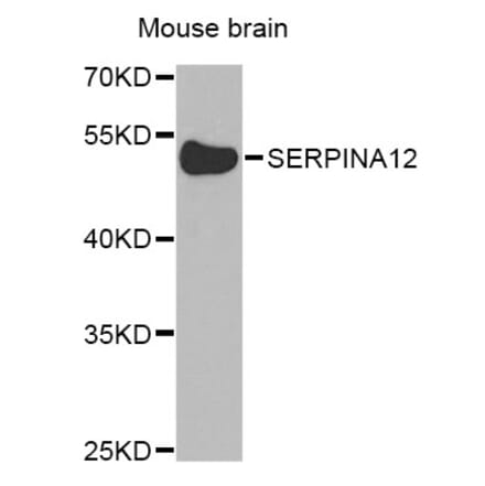 Western Blot - Anti-SERPINA12 Antibody (A8074) - Antibodies.com