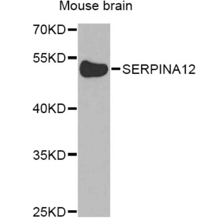 Western Blot - Anti-SERPINA12 Antibody (A8074) - Antibodies.com