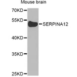 Western Blot - Anti-SERPINA12 Antibody (A8074) - Antibodies.com
