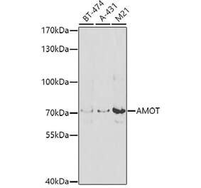 Western Blot - Anti-Angiomotin Antibody (A10287) - Antibodies.com
