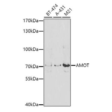 Western Blot - Anti-Angiomotin Antibody (A10287) - Antibodies.com