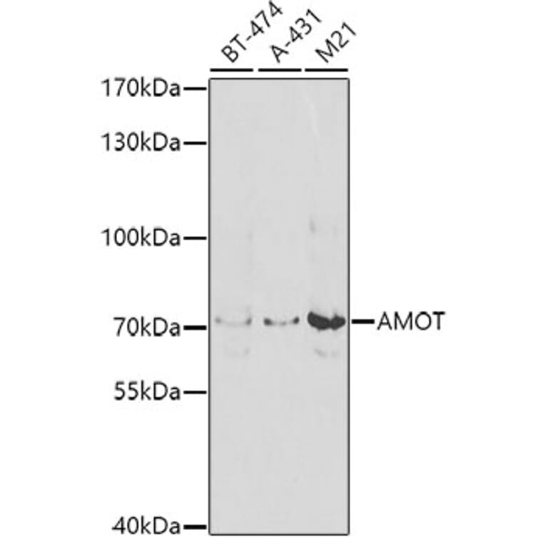 Western Blot - Anti-Angiomotin Antibody (A10287) - Antibodies.com