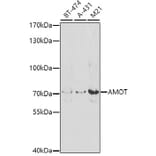 Western Blot - Anti-Angiomotin Antibody (A10287) - Antibodies.com