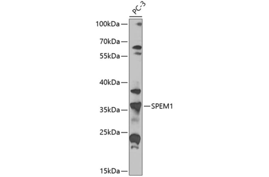 Western Blot - Anti-SPEM1 Antibody (A10288) - Antibodies.com