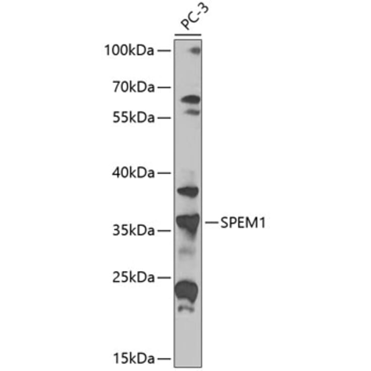 Western Blot - Anti-SPEM1 Antibody (A10288) - Antibodies.com