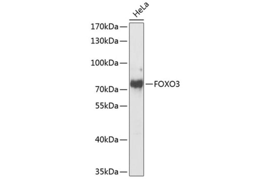 Western Blot - Anti-FOXO3 Antibody (A8079) - Antibodies.com