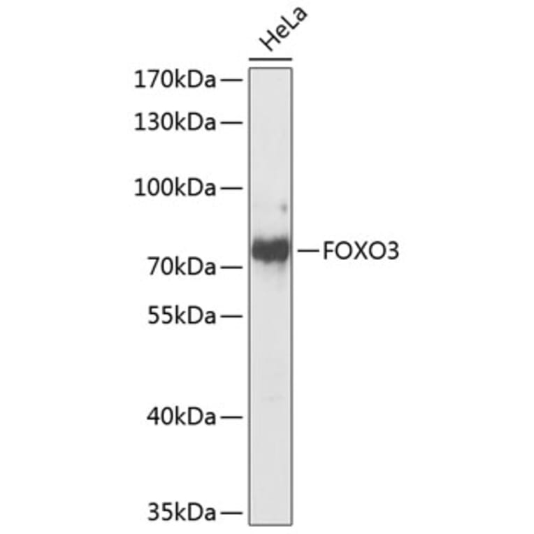 Western Blot - Anti-FOXO3 Antibody (A8079) - Antibodies.com