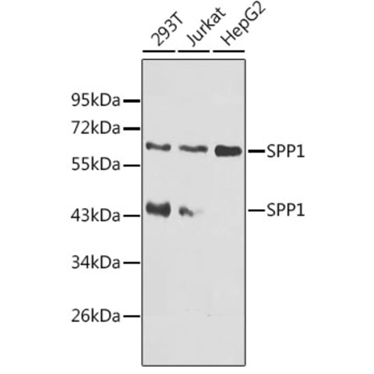 Western Blot - Anti-SPP1 Antibody (A8082) - Antibodies.com