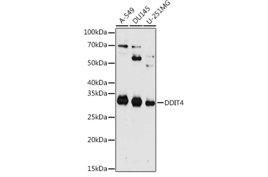 Western Blot - Anti-REDD-1/DDIT4 Antibody (A10292) - Antibodies.com