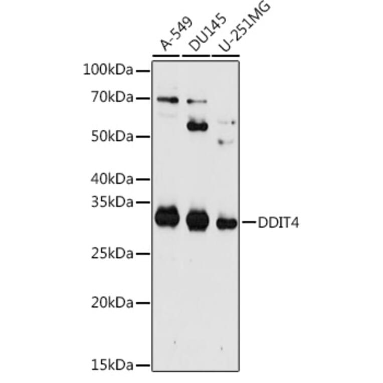 Western Blot - Anti-REDD-1/DDIT4 Antibody (A10292) - Antibodies.com