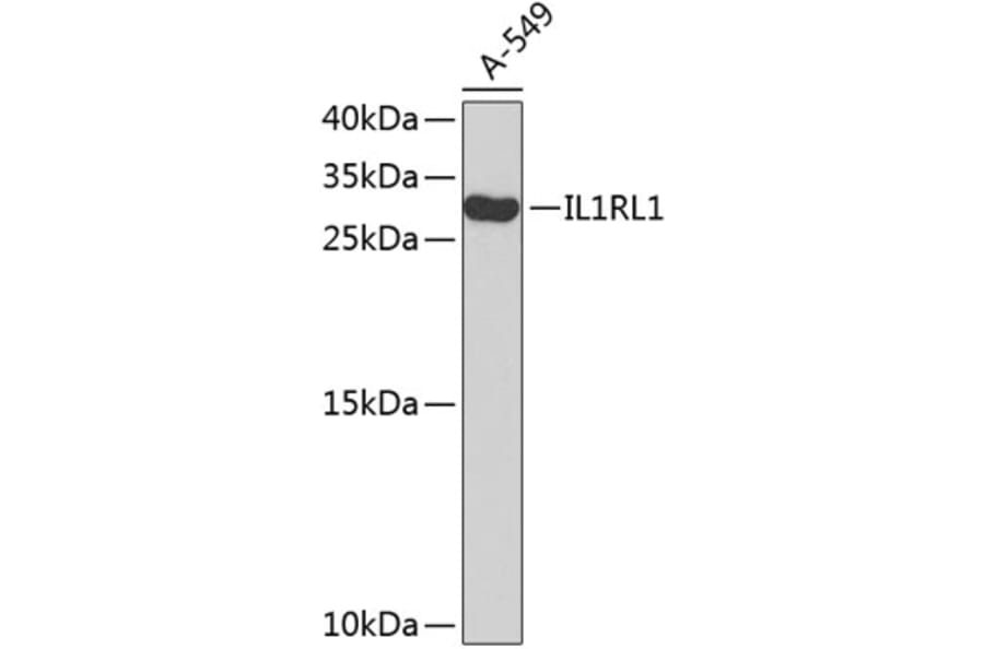 Western Blot - Anti-IL1RL1 Antibody (A8097) - Antibodies.com