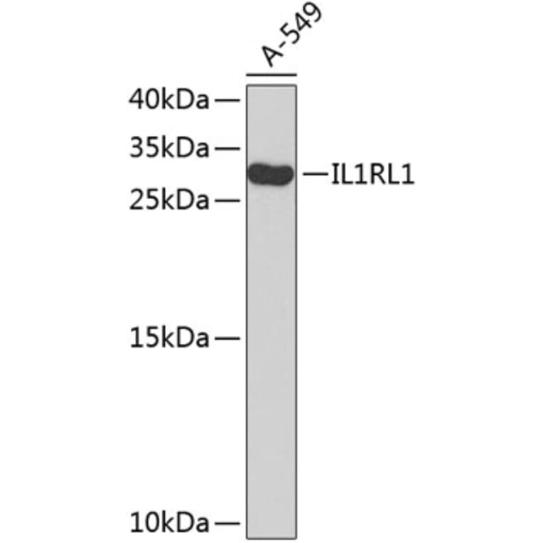 Western Blot - Anti-IL1RL1 Antibody (A8097) - Antibodies.com