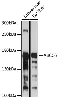 Western blot analysis of extracts of various cell lines, using Anti-ABCC6 Antibody (A8100) at 1:1,000 dilution.
Secondary antibody: Goat Anti-Rabbit IgG (H+L) (HRP) (AS014) at 1:10,000 dilution.
Lysates / proteins: 25µg per lane.
Blocking buffer: 3% non-fat dry milk in TBST.
Detection: ECL Basic Kit (RM00020).
Exposure time: 30s.