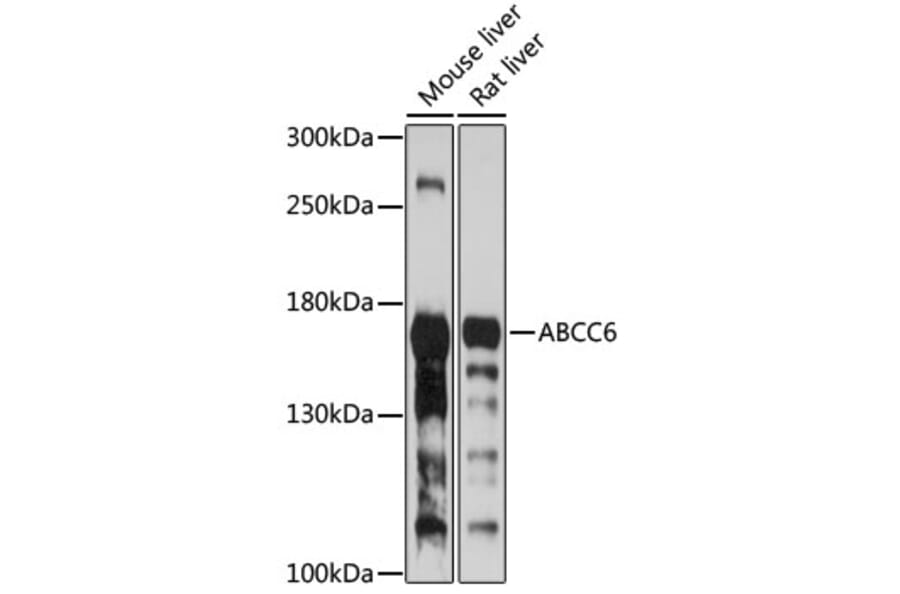 Western Blot - Anti-MRP6/ARA Antibody (A10295) - Antibodies.com