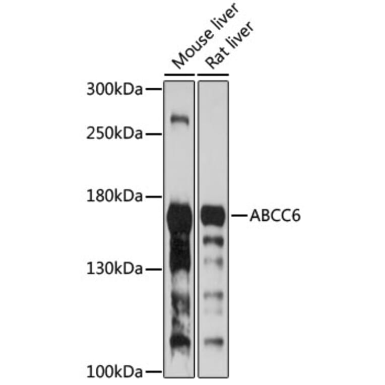 Western Blot - Anti-MRP6/ARA Antibody (A10295) - Antibodies.com