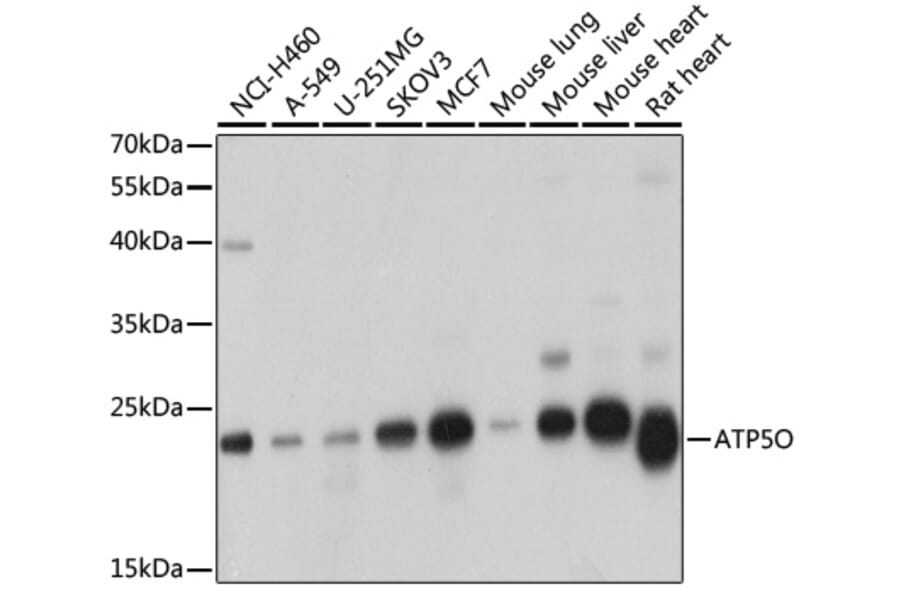 Western Blot - Anti-ATP5O Antibody (A10296) - Antibodies.com