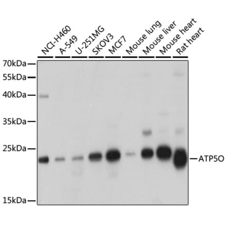 Western Blot - Anti-ATP5O Antibody (A10296) - Antibodies.com