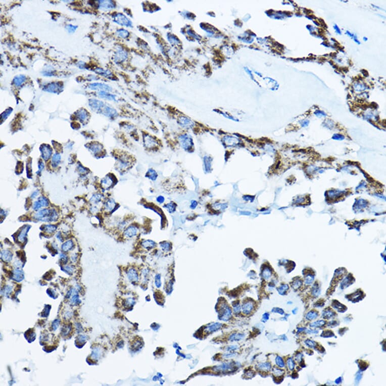 Immunohistochemistry - Anti-ATP5O Antibody (A10296) - Antibodies.com