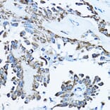 Immunohistochemistry - Anti-ATP5O Antibody (A10296) - Antibodies.com
