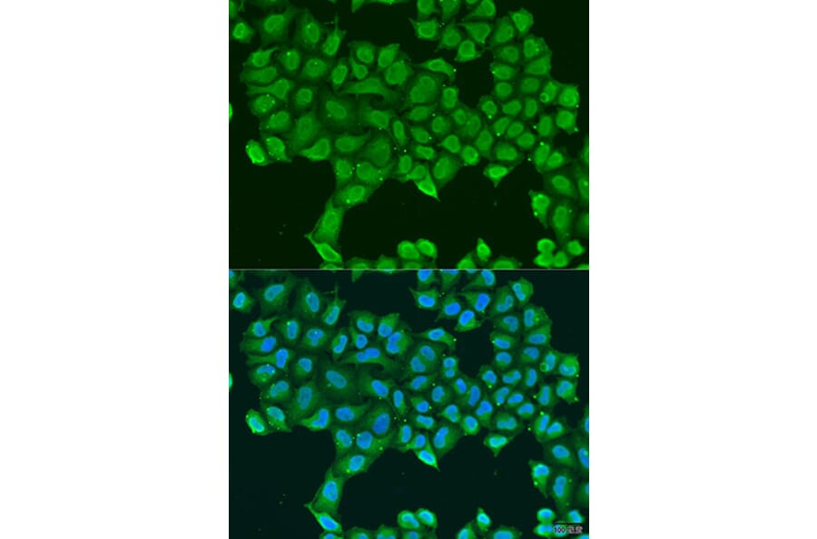 Immunofluorescence - Anti-ATP5O Antibody (A10296) - Antibodies.com