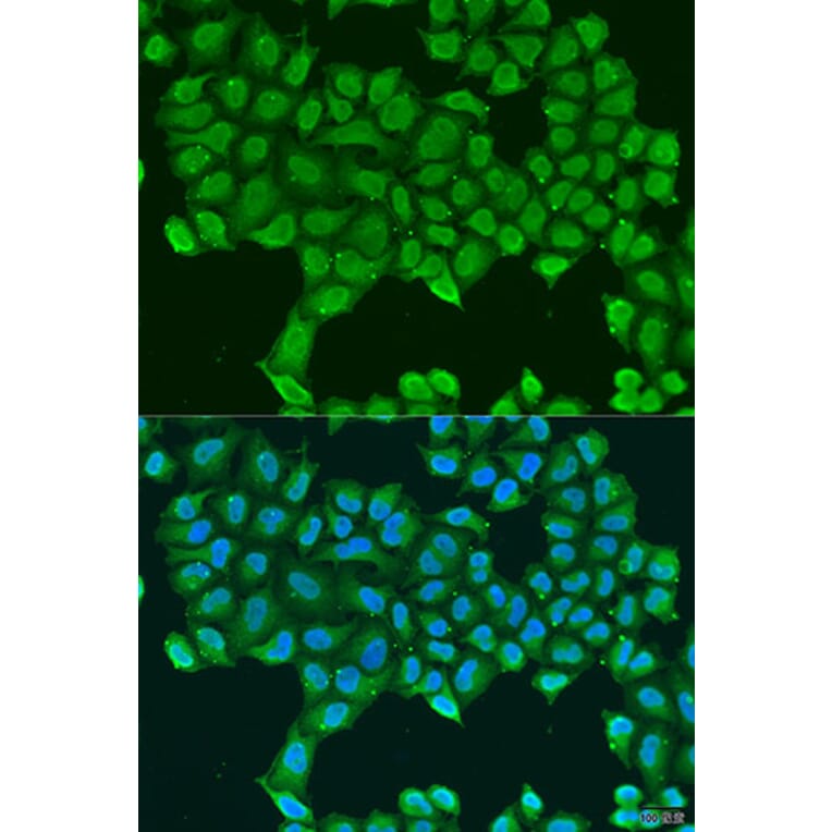 Immunofluorescence - Anti-ATP5O Antibody (A10296) - Antibodies.com