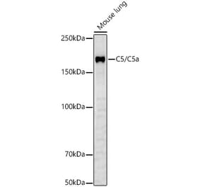 Western Blot - Anti-C5 Antibody (A10297) - Antibodies.com