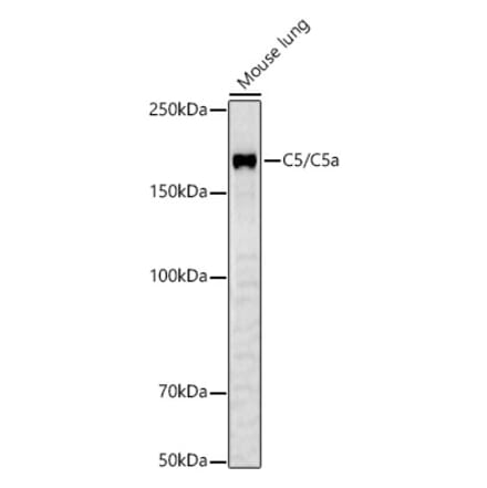 Western Blot - Anti-C5 Antibody (A10297) - Antibodies.com