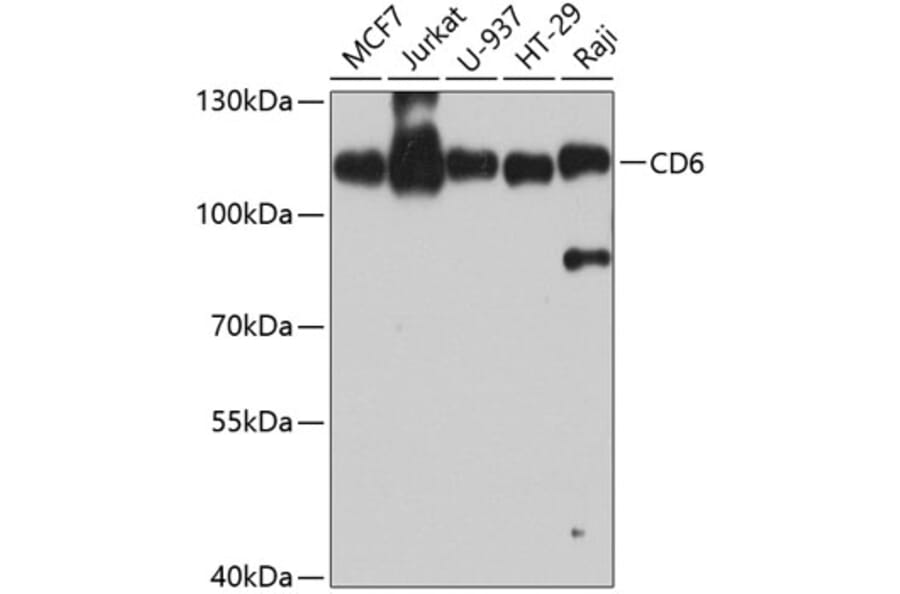 Western Blot - Anti-CD6/T12 Antibody (A10298) - Antibodies.com