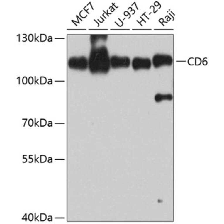 Western Blot - Anti-CD6/T12 Antibody (A10298) - Antibodies.com