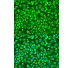 Immunofluorescence - Anti-ENTPD5 Antibody (A8108) - Antibodies.com