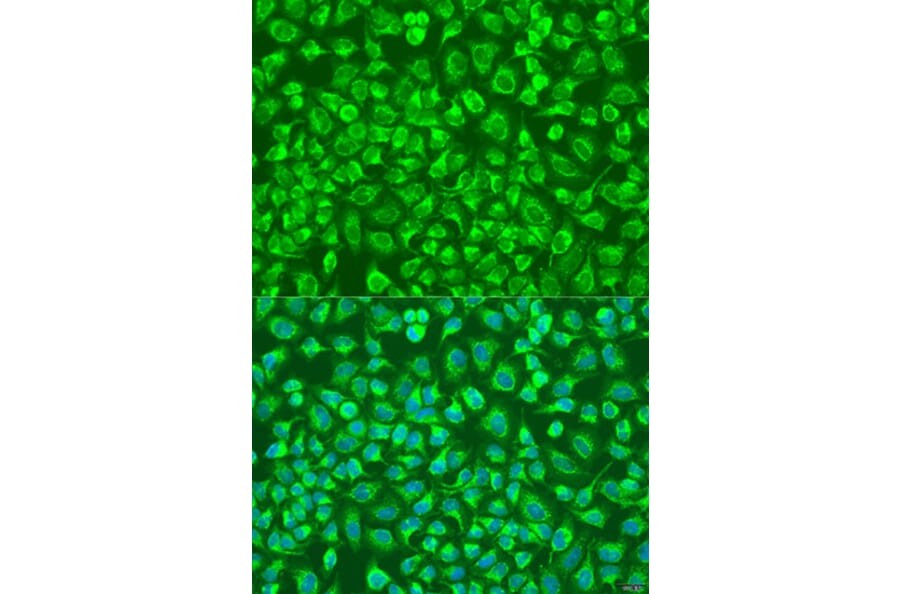 Immunofluorescence - Anti-ENTPD5 Antibody (A8108) - Antibodies.com