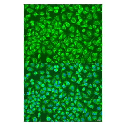 Immunofluorescence - Anti-ENTPD5 Antibody (A10299) - Antibodies.com