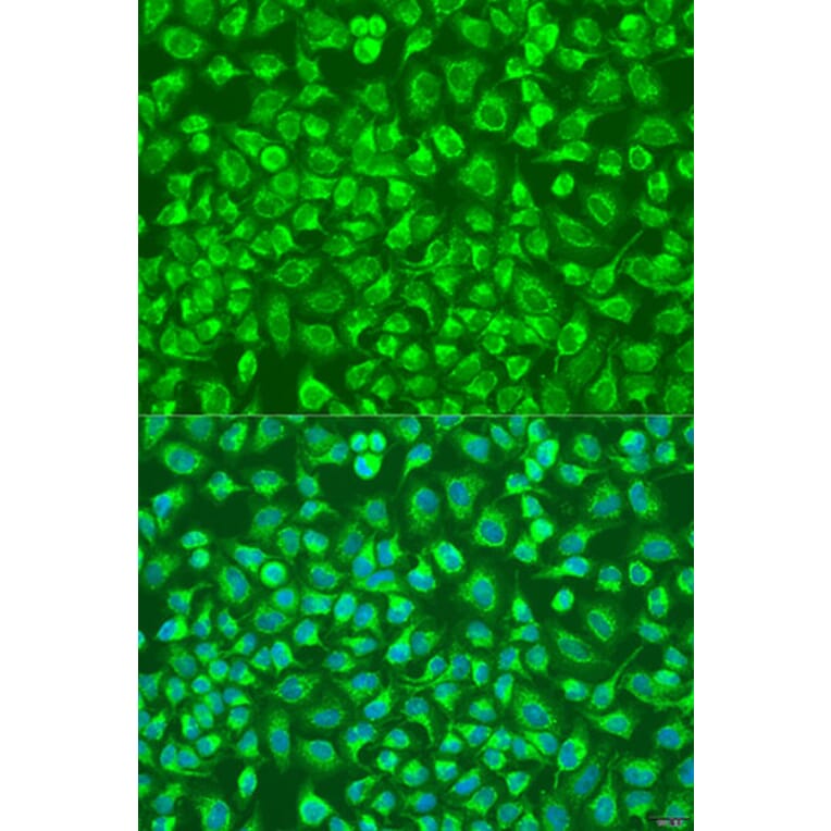 Immunofluorescence - Anti-ENTPD5 Antibody (A8108) - Antibodies.com