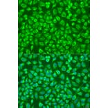 Immunofluorescence - Anti-ENTPD5 Antibody (A8108) - Antibodies.com