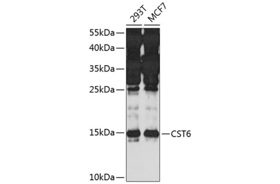 Western Blot - Anti-CST6 Antibody (A10301) - Antibodies.com