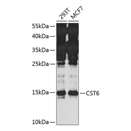 Western Blot - Anti-CST6 Antibody (A10301) - Antibodies.com