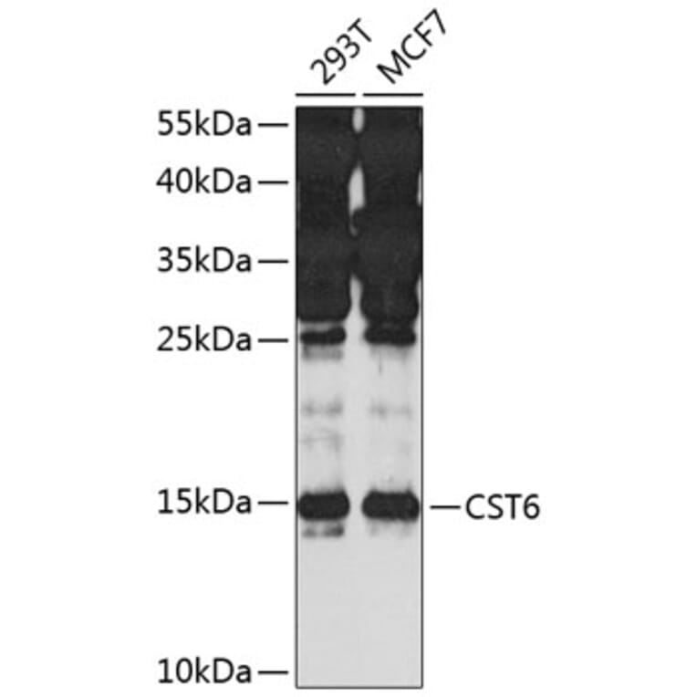 Western Blot - Anti-CST6 Antibody (A10301) - Antibodies.com