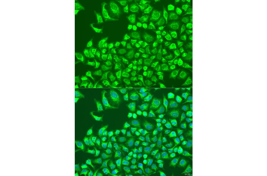 Immunofluorescence - Anti-CST6 Antibody (A10301) - Antibodies.com