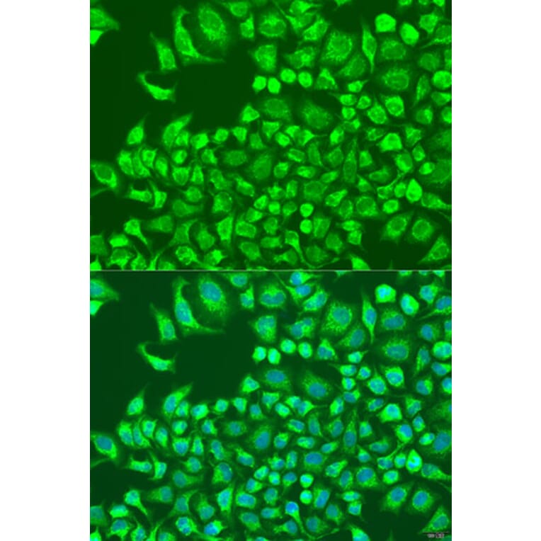 Immunofluorescence - Anti-CST6 Antibody (A10301) - Antibodies.com