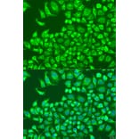 Immunofluorescence - Anti-CST6 Antibody (A10301) - Antibodies.com