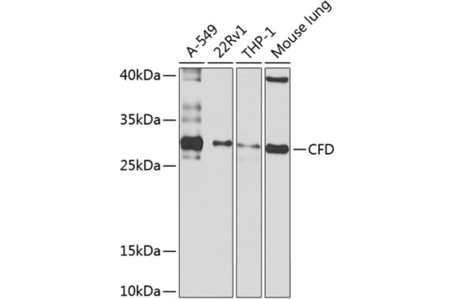 Western Blot - Anti-Factor D/CFD Antibody (A10302) - Antibodies.com
