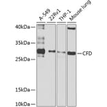 Western Blot - Anti-Factor D/CFD Antibody (A10302) - Antibodies.com