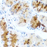 Immunohistochemistry - Anti-LAMB3 Antibody (A8127) - Antibodies.com