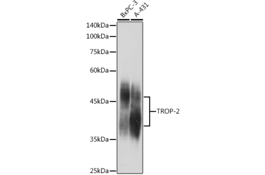 Western Blot - Anti-TROP2 Antibody (A10307) - Antibodies.com
