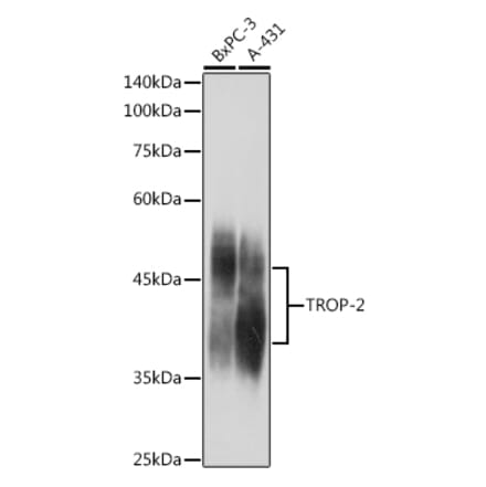 Western Blot - Anti-TROP2 Antibody (A10307) - Antibodies.com