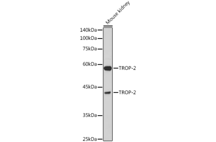 Western Blot - Anti-TROP2 Antibody (A10307) - Antibodies.com