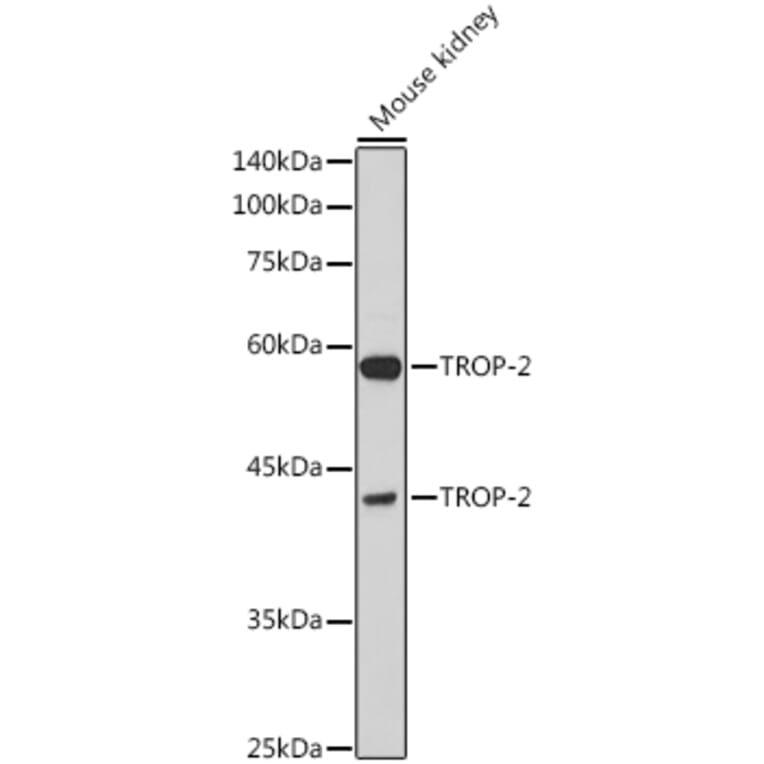Western Blot - Anti-TROP2 Antibody (A10307) - Antibodies.com