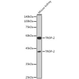 Western Blot - Anti-TROP2 Antibody (A10307) - Antibodies.com
