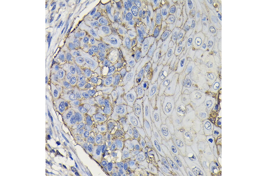 Immunohistochemistry - Anti-TROP2 Antibody (A10307) - Antibodies.com