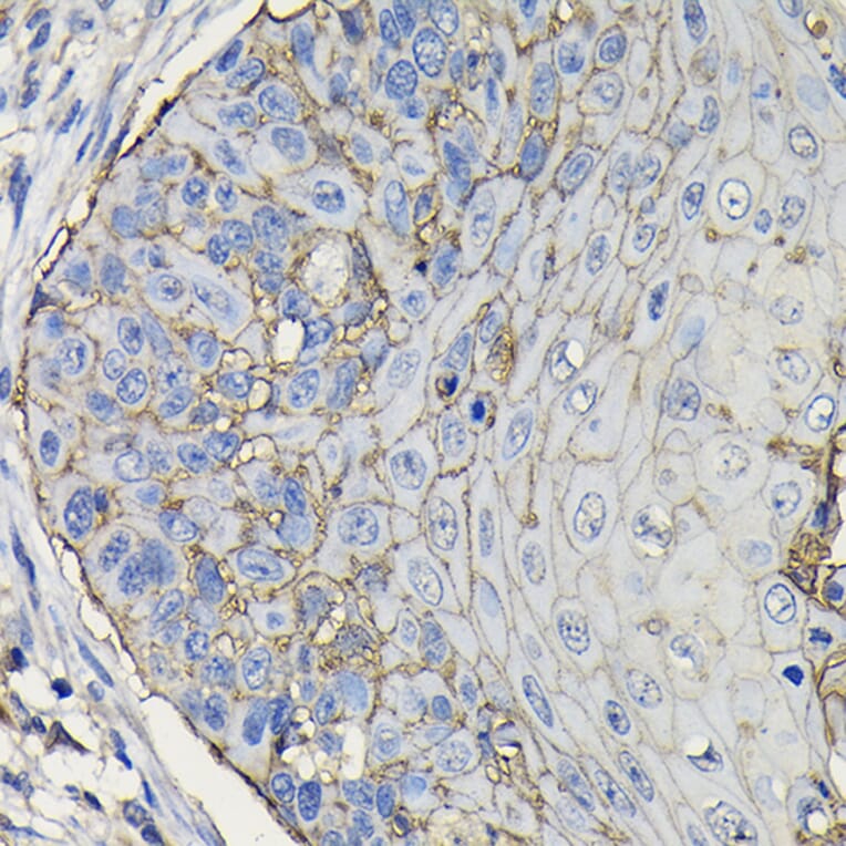 Immunohistochemistry - Anti-TROP2 Antibody (A10307) - Antibodies.com